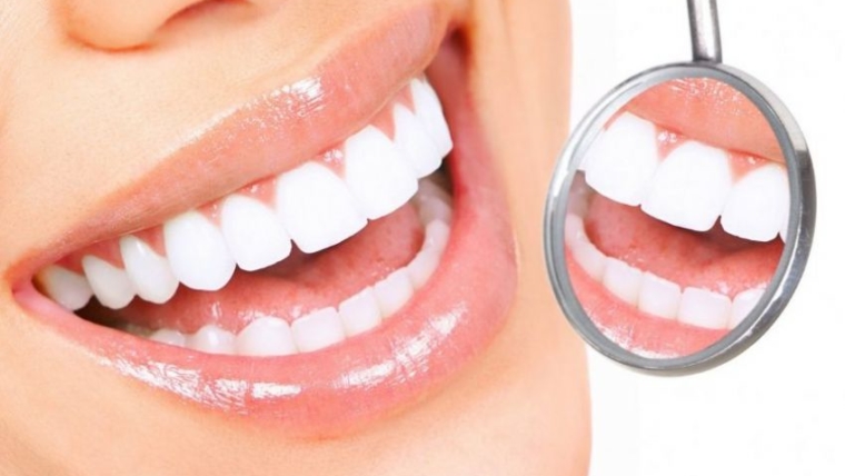 Odontoiatria estetica: tutto quello che c’è da sapere sullo sbiancamento dentale